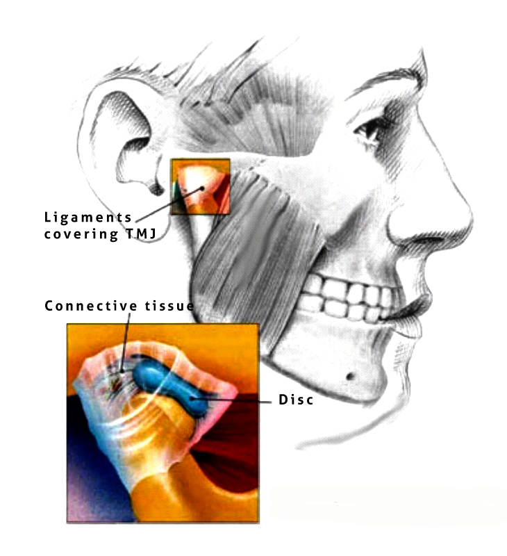 TMJ Sleep Apnea Vivos Dr Rebecca Havel DDS SC