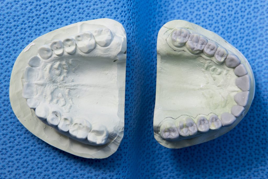 Conventional Dentures Dr. Rebecca Havel DDS, SC